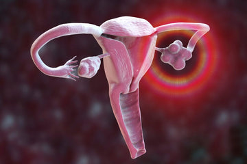 Polycystic Ovary Syndrome (PCOS) and Microbiome