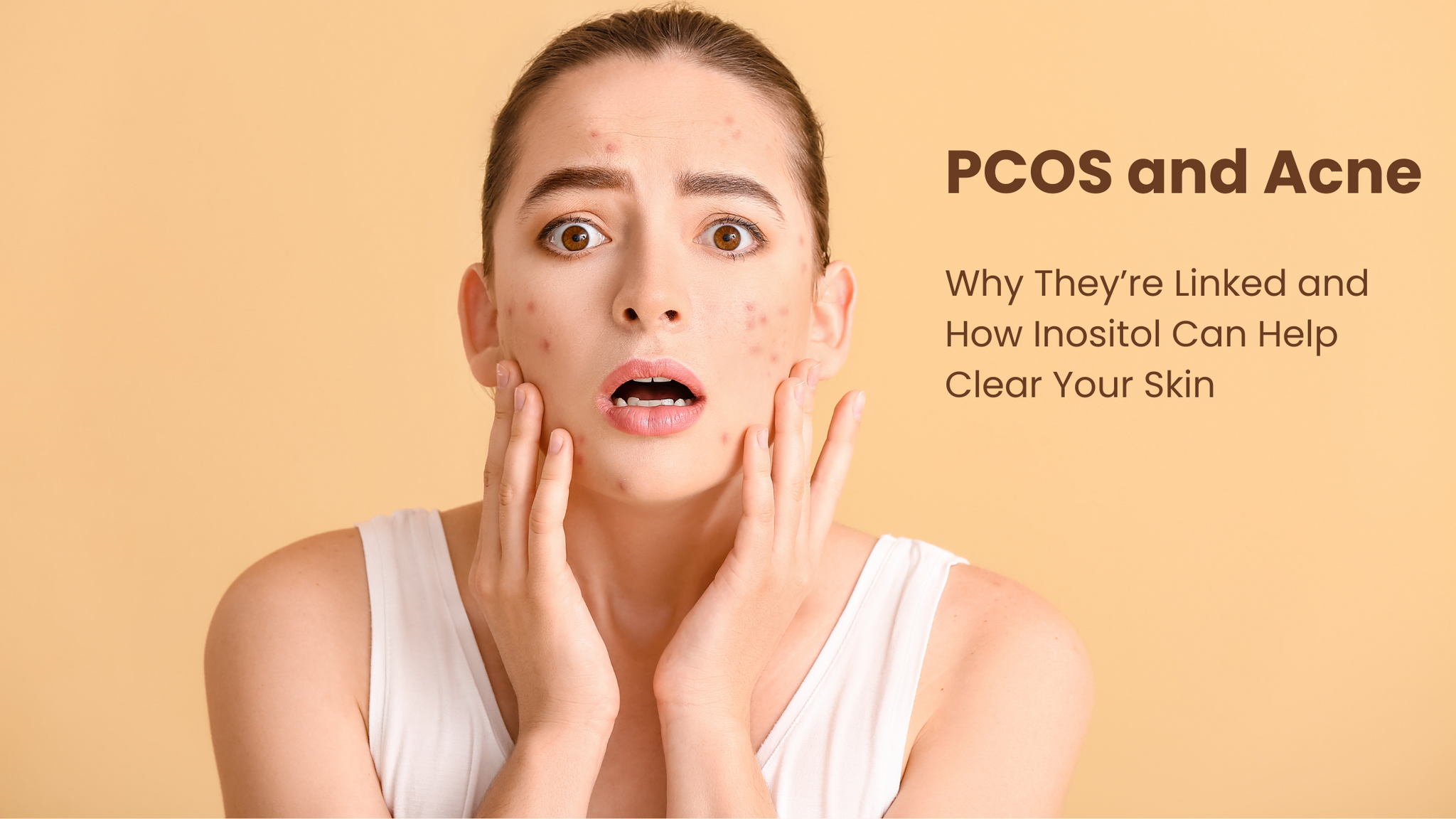 Pcod Acnes PCOS and Acne and the Role of Inositol - Provation Life